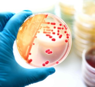 Culture de bactérie en boîte de Pétri - Crédit jarun011